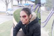 Chocó a una mujer en bicicleta y la dejó abandonada: piden que aparezca